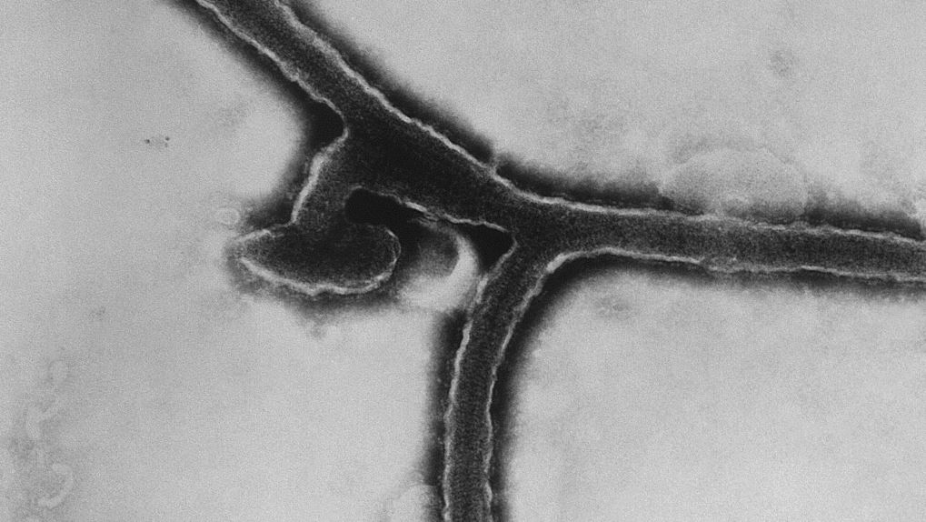 Equatorial Guinea confirms first-ever Marburg virus disease outbreak ...
